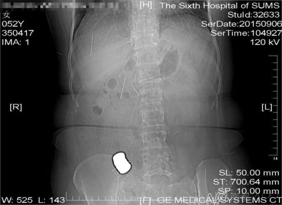 �V��Ů�Ӟ��θ�ʹ����10���9�K���F