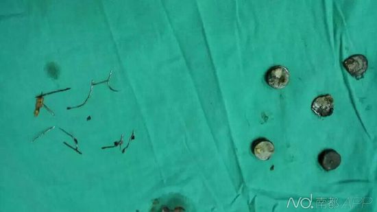 �V��Ů�Ӟ��θ�ʹ����10���9�K���F