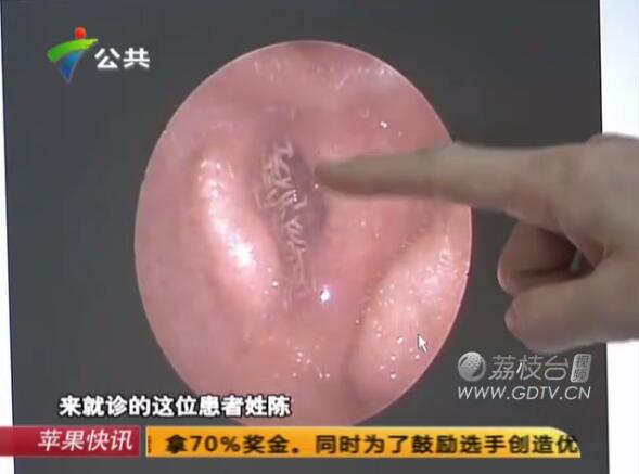 �@�������Ӷ���(n��i)�L�M��ɫ���x��˺ҧ����ʹ��������