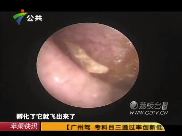 �@�֣����Ӷ���(n��i)�L�M��ɫ���x��˺ҧ����ʹ��������