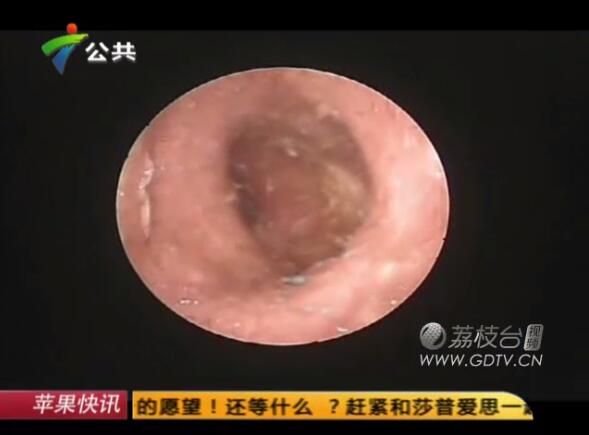 �@�֣����Ӷ���(n��i)�L�M��ɫ���x��˺ҧ����ʹ��������