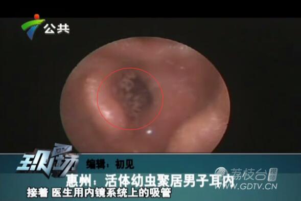 �@�֣����Ӷ���(n��i)�L�M��ɫ���x��˺ҧ����ʹ��������