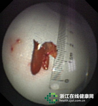 �����ס����β������ǆ��M(j��n)�������Ƥ�ǵ����D��