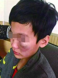 小學(xué)生逃課遭老師毆打 老師:他打罵我在先(圖)