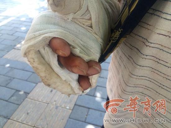 �Ύ�����5�³��ڵ��P�h��ӭ�e����ɻ�r(sh��)�܂��ģ���(d��ng)����ؓ(f��)؟(z��)���b·�ϵ�ˮ�������܇�����ӵ�����(l��i)�r(sh��)������������ץ���������A(y��)�O(sh��)�õ�λ���������֪��ε�܇�͵ض���һ�£������S֮һ�����Ύ������ִ�Ĵָ��СĴָͬ�r(sh��)���A�ڃɸ��������g����(d��ng)��(ch��ng)������