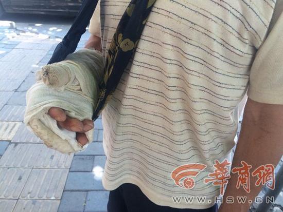 7��22�����A�̈�(b��o)ӛ��ݚ�D(zhu��n)(li��n)ϵ���˹��^��ĳ�����f�ѽ�(j��ng)�o�Ύ����|���˽��f(w��n)Ԫ���ί��M(f��i)�����F(xi��n)�����]�X�����o(w��)�ܞ��������P�hס����ؓ(f��)؟(z��)���µĹ����ˆT�t�f���Ύ����ǹ��^���M(j��n)ȥ�ɻ�ģ�����ֻؓ(f��)؟(z��)�{(di��o)��������B(t��i)���^�m(x��)�ش��й�������̎��������