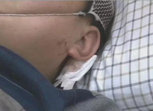 �����һ�𱻴����߀��������߅�����ϵ��ܴ�������^�t(y��)�������Д����ܴ�����~��Ƥ��ܛ�M�����[Û��һֱ���ڻ��Ԡ�B(t��i)��Ŀǰ߀�]�ж��^Σ�U�ڡ�